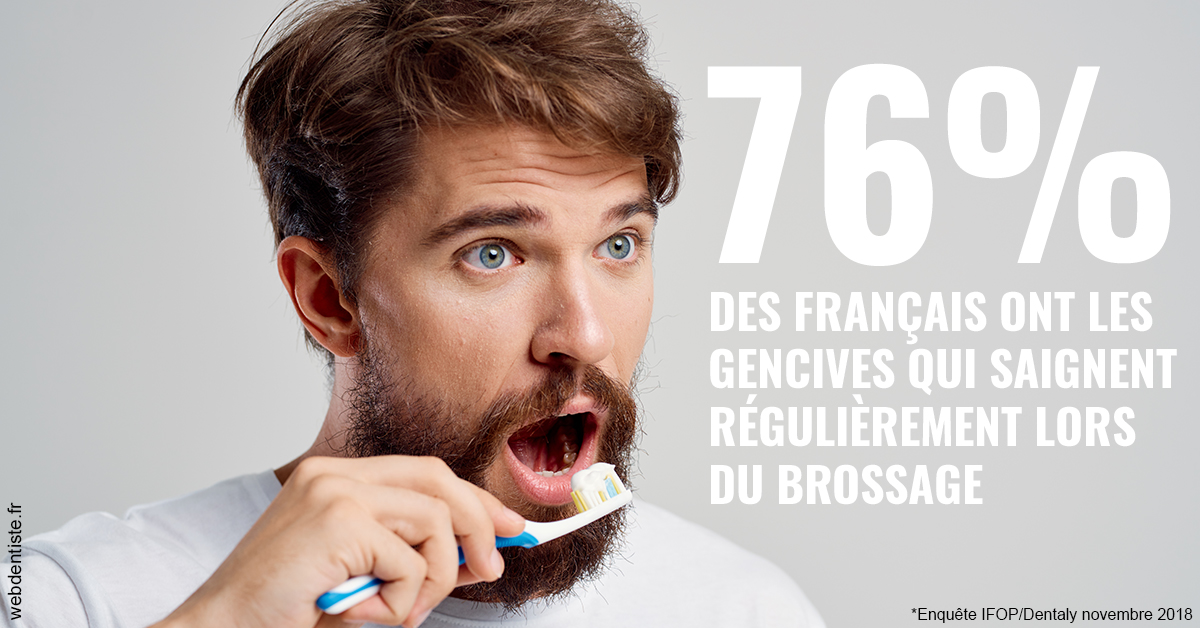 https://selarl-dr-robbiani-eric.chirurgiens-dentistes.fr/76% des Français 2