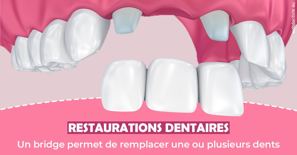 https://selarl-dr-robbiani-eric.chirurgiens-dentistes.fr/Bridge remplacer dents 2