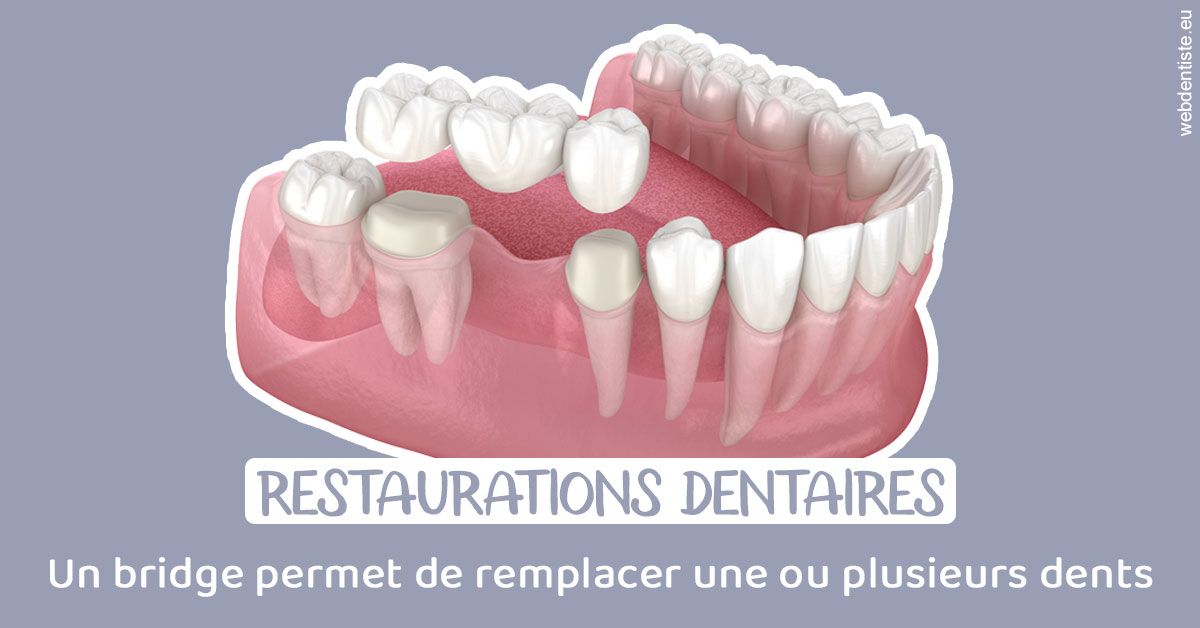 https://selarl-dr-robbiani-eric.chirurgiens-dentistes.fr/Bridge remplacer dents 1