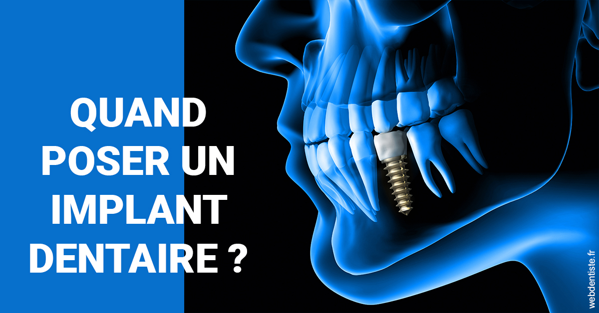 https://selarl-dr-robbiani-eric.chirurgiens-dentistes.fr/Les implants 1