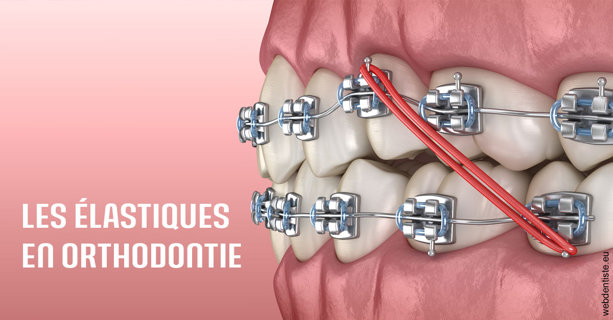 https://selarl-dr-robbiani-eric.chirurgiens-dentistes.fr/Elastiques orthodontie 2
