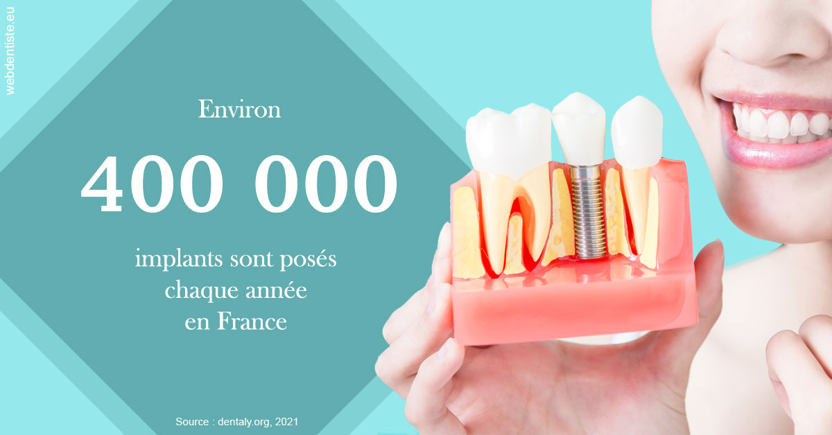 https://selarl-dr-robbiani-eric.chirurgiens-dentistes.fr/Pose d'implants en France 2